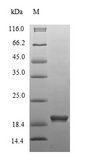 HMG-CoA Reductase / HMGCR Protein - (Tris-Glycine gel) Discontinuous SDS-PAGE (reduced) with 5% enrichment gel and 15% separation gel.