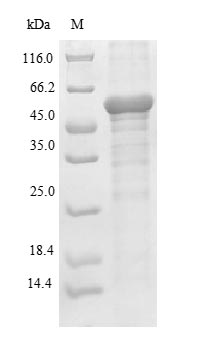 HNRNPA2B1 Protein - (Tris-Glycine gel) Discontinuous SDS-PAGE (reduced) with 5% enrichment gel and 15% separation gel.