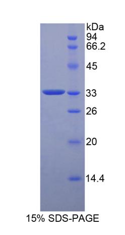 HP / Haptoglobin Protein - Recombinant  Haptoglobin By SDS-PAGE