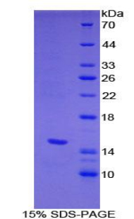 HPSE / Heparanase Protein - Recombinant Heparanase By SDS-PAGE