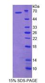 HRG Protein - Recombinant Histidine Rich Glycoprotein By SDS-PAGE