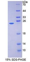 HSD17B10 / HADH2 Protein - Recombinant 17-Beta-Hydroxysteroid Dehydrogenase Type 10 By SDS-PAGE