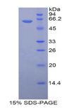 HSD17B12 Protein - Recombinant 17-Beta-Hydroxysteroid Dehydrogenase Type 12 By SDS-PAGE