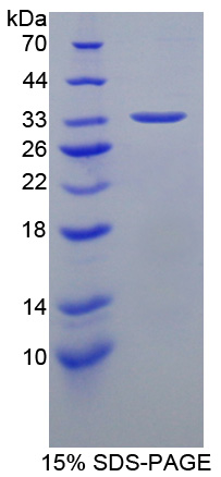 HSF4 Protein - Recombinant  Heat Shock Transcription Factor 4 By SDS-PAGE