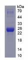 HSPA5 / GRP78 / BiP Protein - Recombinant Heat Shock 70kDa Protein 5 By SDS-PAGE