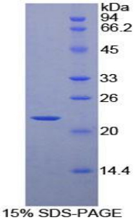 HSPB2 / HSP27 Protein - Recombinant Heat Shock Protein Beta 2 By SDS-PAGE