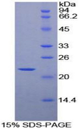 HSPB2 / HSP27 Protein - Recombinant Heat Shock Protein Beta 2 By SDS-PAGE