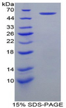 HSPD1 / HSP60 Protein - Recombinant Heat Shock 60kD Protein 1, Chaperonin By SDS-PAGE