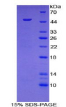HYAL1 Protein - Recombinant Hyaluronoglucosaminidase 1 By SDS-PAGE