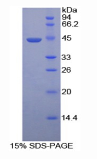 HYAL2 Protein - Recombinant Hyaluronoglucosaminidase 2 By SDS-PAGE
