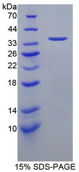 ICAM-1 / CD54 Protein - Recombinant Intercellular Adhesion Molecule 1 By SDS-PAGE