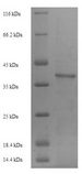 ICAM4 / CD242 Protein - (Tris-Glycine gel) Discontinuous SDS-PAGE (reduced) with 5% enrichment gel and 15% separation gel.