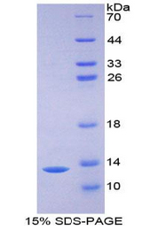 ICAM5 / ICAM-5 Protein - Recombinant Intercellular Adhesion Molecule 5 By SDS-PAGE