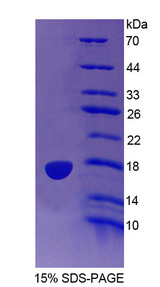 IDO2 / INDOL1 Protein - Recombinant Indoleamine-2,3-Dioxygenase 2 By SDS-PAGE