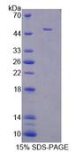 Ifna11 / Interferon Alpha 11 Protein - Recombinant Interferon Alpha 11 By SDS-PAGE