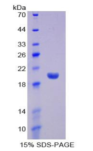 IFNA13 Protein - Recombinant Interferon Alpha 13 By SDS-PAGE