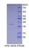 IFNA4 / Interferon Alpha 4 Protein - Recombinant Interferon Alpha 4 By SDS-PAGE
