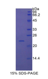 IFNA7 / Interferon Alpha 7 Protein - Recombinant Interferon Alpha 7 By SDS-PAGE