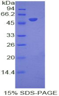 IFNA8 / Interferon Alpha 8 Protein - Recombinant Interferon Alpha 8 By SDS-PAGE
