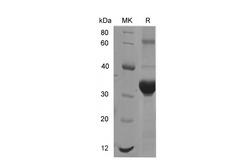 IFNAR1 / IFNAR Protein - Recombinant Mouse IFNAR1 Protein (His Tag)-Elabscience