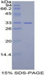 IGF2BP2 Protein - Recombinant Insulin Like Growth Factor 2 mRNA Binding Protein 2 By SDS-PAGE