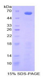 IGFBP2 / IGF-BP53 Protein - Recombinant Insulin Like Growth Factor Binding Protein 2 By SDS-PAGE