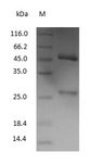 Mouse IgG Protein - (Tris-Glycine gel) Discontinuous SDS-PAGE (reduced) with 5% enrichment gel and 15% separation gel.