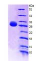 IL-22BP / IL22RA2 Protein - Recombinant  Interleukin 22 Receptor Alpha 2 By SDS-PAGE