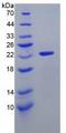 IL11 Protein - Recombinant  Interleukin 11 By SDS-PAGE
