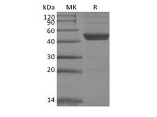 IL11RA Protein - Recombinant Mouse IL-11RA (C-6His)
