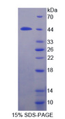 IL12RB1 / CD212 Protein - Recombinant  Interleukin 12 Receptor Beta 1 By SDS-PAGE