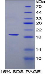 IL12RB2 Protein - Recombinant Interleukin 12 Receptor Beta 2 By SDS-PAGE