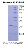 IL12RB2 Protein - Recombinant Interleukin 12 Receptor Beta 2 By SDS-PAGE