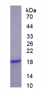 IL13RA1 / IL13R Alpha 1 Protein - Recombinant Interleukin 13 Receptor Alpha 1 By SDS-PAGE