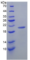 IL17C Protein - Recombinant Interleukin 17C By SDS-PAGE