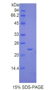 IL17RB Protein - Recombinant Interleukin 17 Receptor B By SDS-PAGE