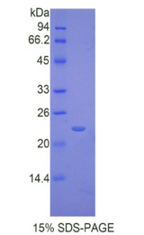IL17RB Protein - Recombinant Interleukin 17 Receptor B By SDS-PAGE