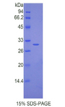 IL17RC Protein - Recombinant Interleukin 17 Receptor C By SDS-PAGE