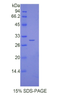 IL17RD Protein - Recombinant Interleukin 17 Receptor D By SDS-PAGE