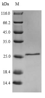 IL18 Protein - (Tris-Glycine gel) Discontinuous SDS-PAGE (reduced) with 5% enrichment gel and 15% separation gel.