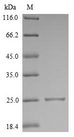 IL18 Protein - (Tris-Glycine gel) Discontinuous SDS-PAGE (reduced) with 5% enrichment gel and 15% separation gel.