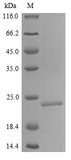 IL18 Protein - (Tris-Glycine gel) Discontinuous SDS-PAGE (reduced) with 5% enrichment gel and 15% separation gel.