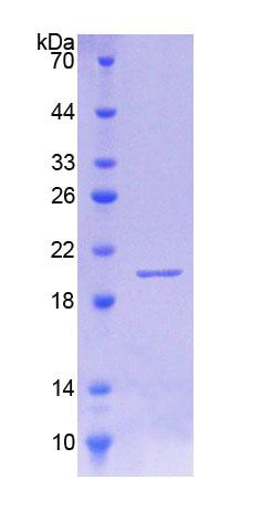 IL18BP Protein - Recombinant Interleukin 18 Binding Protein By SDS-PAGE