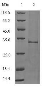 IL1F10 Protein - (Tris-Glycine gel) Discontinuous SDS-PAGE (reduced) with 5% enrichment gel and 15% separation gel.