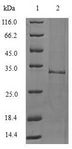 IL1F10 Protein - (Tris-Glycine gel) Discontinuous SDS-PAGE (reduced) with 5% enrichment gel and 15% separation gel.