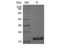 IL1F9 Protein - Recombinant Mouse Interleukin-36 gamma/IL-36 gamma/IL-1F9