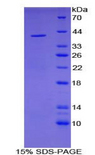 IL1R1 Protein
