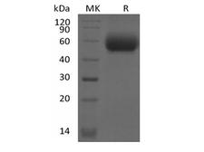 IL1RL2 Protein - Recombinant Mouse IL-1 Receptor-Like 2/IL-1RL2/IL-1Rrp2/IL-36R (C-6His)