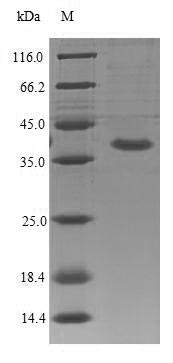IL1RL2 Protein - (Tris-Glycine gel) Discontinuous SDS-PAGE (reduced) with 5% enrichment gel and 15% separation gel.