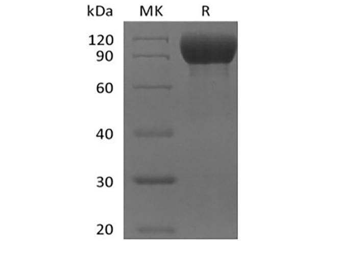 IL1RL2 Protein - Recombinant Mouse IL-1 Receptor-Like 2/IL-1RL2/IL-1Rrp2/IL-36R (C-Fc)